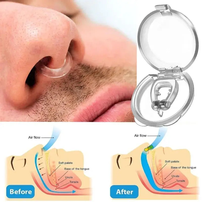 Anti-Snoring Nose Clip Snoring Prevention Solution